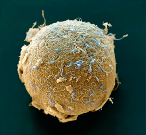 eicel met spermatozoa, mijn passie http://www.embryologisch.nl