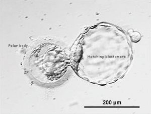 www.embryologisch.nl Hatching